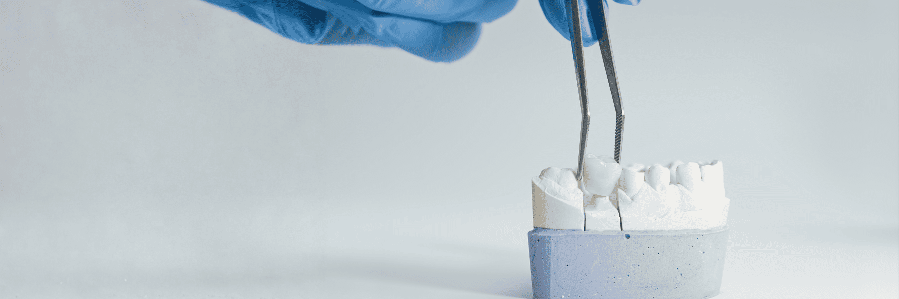 hand holding tweezers placing a crown