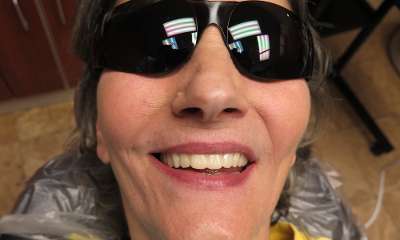 patient after Full Arch Dental Implants