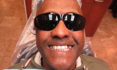 patient before Full Arch Dental Implants
