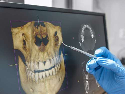 CBCT Cone Beam Technology